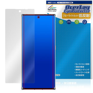 ZTE Axon 50 Ultra 50 Standard Edition ی tB OverLay Eye Protector ᔽ for [bgeB[C[ u[CgJbg ˖h~