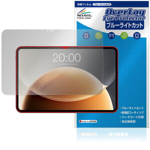 Teclast T65 Tablet ی tB OverLay Eye Protector for eNXg ^ubg tی ڂɗD u[CgJbg