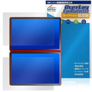 GZBOX 10.95C` fA^b`XN[ DS18 ی tB OverLay Eye Protector ᔽ tی u[CgJbg ˖h~