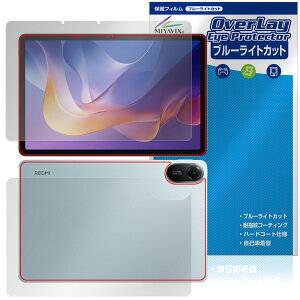 Xiaomi Redmi Pad 2 Wi-Fif \ w tB OverLay Eye Protector for VI~[ ^ubg ڂɗD u[CgJbg