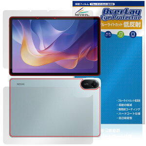 Xiaomi Redmi Pad 2 Wi-Fif \ w tB OverLay Eye Protector ᔽ for VI~[ ^ubg u[CgJbg