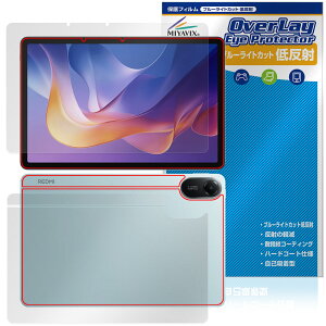 Xiaomi Redmi Pad 2 4G Z[f \ w tB OverLay Eye Protector ᔽ for VI~[ ^ubg u[CgJbg
