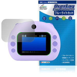 ͂Ղ ی tB OverLay Eye Protector for RN dqߋ tی ڂɗD u[CgJbg