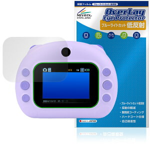 ͂Ղ ی tB OverLay Eye Protector ᔽ for RN dqߋ tی u[CgJbg ˖h~