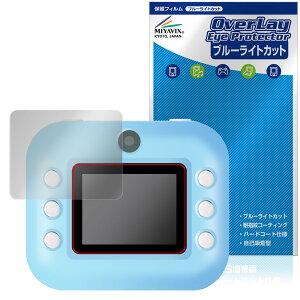 ݂R炵 vgfWJ ی tB OverLay Eye Protector for dqߋ tی ڂɗD u[CgJbg