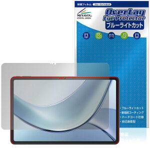 DOOGEE V Pad ی tB OverLay Eye Protector for hD[W[ ^ubg tی ڂɗD u[CgJbg