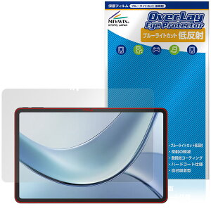 DOOGEE V Pad ی tB OverLay Eye Protector ᔽ for hD[W[ ^ubg tی u[CgJbg ˖h~
