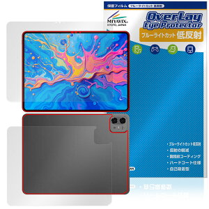 Teclast ArtPad Pro \ w tB OverLay Eye Protector ᔽ for eNXg A[gpbhv u[CgJbg ˖h~