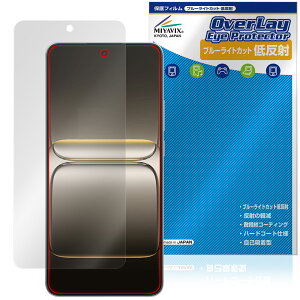 OnePlus Nord CE5 �ی� �t�B���� OverLay Eye Protector �ᔽ�� for �����v���X �m�[�h �t���ی� �u���[���C�g�J�b�g ���˖h�~