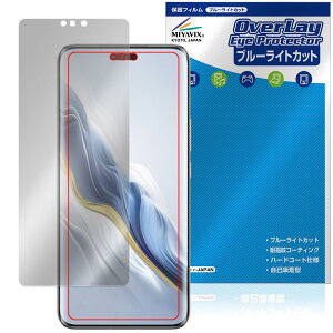 Honor Magic6 Pro �ی� �t�B���� OverLay Eye Protector for �I�i�[ �}�W�b�N �t���ی� �ڂɗD���� �u���[���C�g�J�b�g
