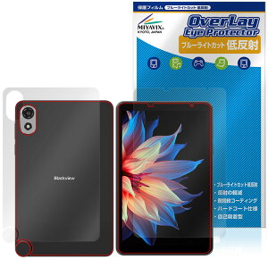 Blackview ZENO 1 �\�� �w�� �t�B���� OverLay Eye Protector �ᔽ�� for �u���b�N�r���[ �^�u���b�g �u���[���C�g�J�b�g ���˖h�~