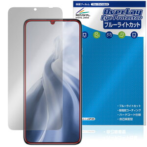 OUKITEL C51 ی tB OverLay Eye Protector for IELe X}[gtH tی ڂɗD u[CgJbg