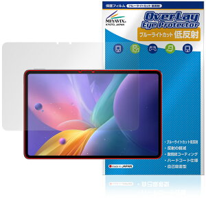 nubia Pad Pro �ی� �t�B���� OverLay Eye Protector �ᔽ�� for �[�b�g�e�B�C�[ �k�r�A�p�b�h �t���ی� �u���[���C�g�J�b�g ���˖h�~