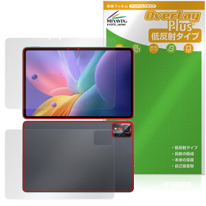 nubia Pad Pro �\�� �w�� �t�B���� OverLay Plus for �[�b�g�e�B�C�[ �k�r�A�p�b�h �A���`�O���A ���˖h�~ ����� �w��h�~