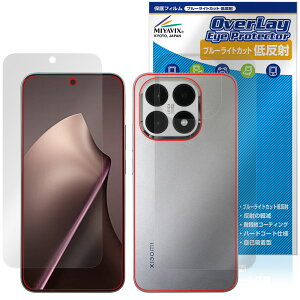 Xiaomi 15T �\�� �w�� �t�B���� OverLay Eye Protector �ᔽ�� for �V���I�~�[ �X�}�[�g�t�H�� �u���[���C�g�J�b�g ���˖h�~