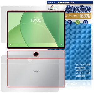 OPPO Pad SE \ w tB OverLay Eye Protector ᔽ for Ib| pbh ^ubg u[CgJbg ˖h~