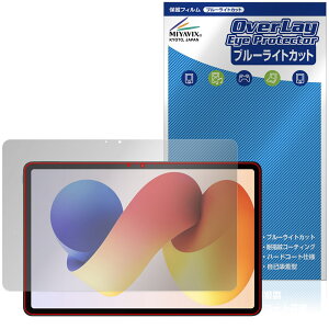 Xiaomi REDMI Pad 2 Pro 5G / Pad 2 Pro یtB OverLay Eye Protector for VI~[ h~ pbh u[CgJbg