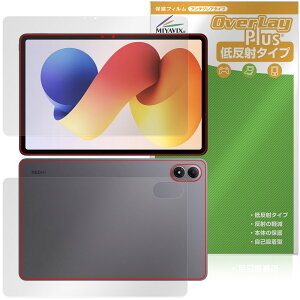 Xiaomi REDMI Pad 2 Pro 5G / Pad 2 Pro \ wʃtB OverLay Plus for VI~[ h~ pbh A`OA  wh~
