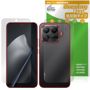 Xiaomi 15T Pro �\�� �w�� �t�B���� OverLay Plus for �V���I�~�[ �X�}�[�g�t�H�� �A���`�O���A ���˖h�~ ����� �w��h�~