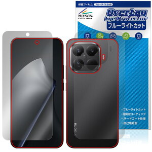 Xiaomi 15T Pro �\�� �w�� �t�B���� OverLay Eye Protector for �V���I�~�[ �X�}�[�g�t�H�� �ڂɗD���� �u���[���C�g�J�b�g