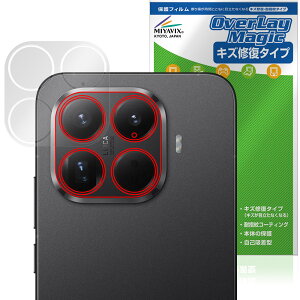 Xiaomi 15T Pro ���A�J�����p �ی�t�B���� OverLay Magic for �V���I�~�[ �X�}�[�g�t�H�� ���C�� �ώw�� �w��h�~ �R�[�e�B���O