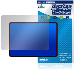 Teclast ArtPad Air Tablet ی tB OverLay Eye Protector for eNXg A[gpbhv tی u[CgJbg