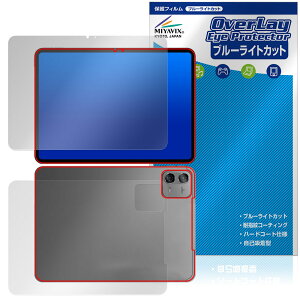Teclast ArtPad Air Tablet \ w tB OverLay Eye Protector for eNXg A[gpbhv ڂɗD u[CgJbg