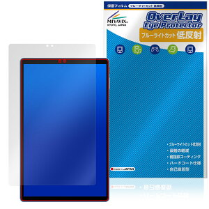 ALLDOCUBE iPlay 70 ی tB OverLay Eye Protector ᔽ for I[hL[u ACvC tی u[CgJbg