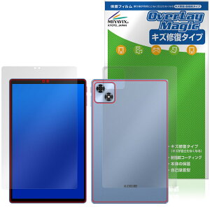 ALLDOCUBE iPlay 70 \ w tB OverLay Magic for I[hL[u ACvC C ώw wh~ R[eBO