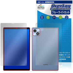 ALLDOCUBE iPlay 70 \ w tB OverLay Eye Protector for I[hL[u ACvC ڂɗD u[CgJbg