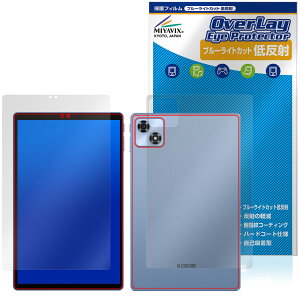 ALLDOCUBE iPlay 70 \ w tB OverLay Eye Protector ᔽ for I[hL[u ACvC u[CgJbg ˖h~