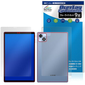 ALLDOCUBE iPlay 70 \ w tB OverLay Eye Protector 9H for I[hL[u ACvC 9H dx u[CgJbg