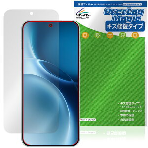 vivo X300 Pro �ی� �t�B���� OverLay Magic for ���B�[���H �G�b�N�X �t���ی� ���C�� �ώw�� �w��h�~ �R�[�e�B���O