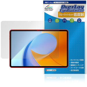 ALLDOCUBE iPlay 70 Max Pro یtB OverLay Eye Protector ᔽ for I[hL[u ACvC u[CgJbg ˖h~