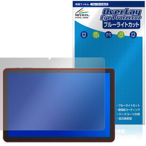 PHILIPS T7315 یtB OverLay Eye Protector for tBbvX ^ubg tی ڂɗD u[CgJbg