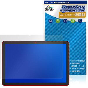 PHILIPS T7315 یtB OverLay Eye Protector ᔽ for tBbvX ^ubg tی u[CgJbg ˖h~