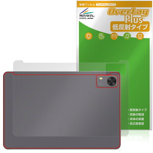 PHILIPS T7315 w یtB OverLay Plus for tBbvX ^ubg {̕ی tB 炳G ᔽˑf