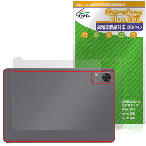 PHILIPS T7315 w یtB OverLay Plus Lite for tBbvX ^ubg {̕ی tB 炳G ᔽˑf