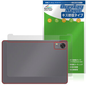 PHILIPS T7315 w یtB OverLay Magic for tBbvX ^ubg {̕ی tB C wh~ R[eBO