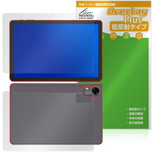 PHILIPS T7315 \ w یtB OverLay Plus for tBbvX ^ubg A`OA ˖h~  wh~