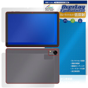 PHILIPS T7315 \ w یtB OverLay Eye Protector ᔽ for tBbvX ^ubg u[CgJbg ˖h~