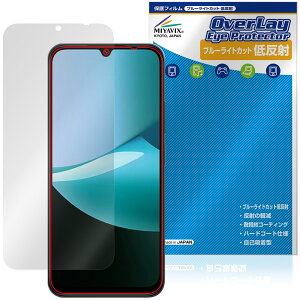 Xiaomi Redmi 15C �ی�t�B���� OverLay Eye Protector �ᔽ�� for �V���I�~�[ ���h�~ �t���ی� �u���[���C�g�J�b�g ���˖h�~