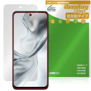 nubia S2 �ی�t�B���� OverLay Plus for �k�r�A �G�X�V���[�Y �t���ی� �A���`�O���A ���˖h�~ ����� �w��h�~