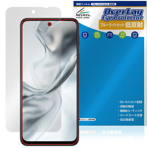nubia S2 �ی�t�B���� OverLay Eye Protector �ᔽ�� for �k�r�A �G�X�V���[�Y �t���ی� �u���[���C�g�J�b�g ���˖h�~