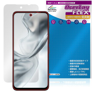 nubia S2 �ی�t�B���� OverLay FLEX �ᔽ�� for �k�r�A �G�X�V���[�Y �t���ی� �ȖʑΉ� �_��f�� ���˖h�~ �Ռ��z��