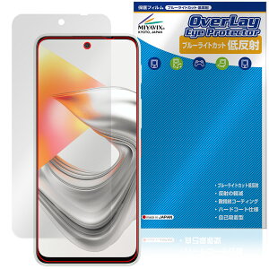 nubia S2 Lite / nubia S2e / nubia S2R �ی�t�B���� OverLay Eye Protector �ᔽ�� for �k�r�A �G�X �u���[���C�g�J�b�g ���˖h�~