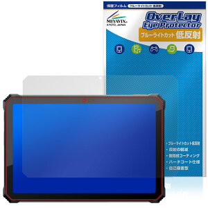 Blackview Active 12 Pro �ی�t�B���� OverLay Eye Protector �ᔽ�� for �u���b�N�r���[ �A�N�e�B�u �u���[���C�g�J�b�g ���˖h�~