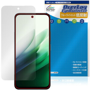 Xiaomi REDMI 15 5G �ی�t�B���� OverLay Eye Protector �ᔽ�� for �V���I�~�[ ���b�h�~�[ �t���ی� �u���[���C�g�J�b�g ���˖h�~