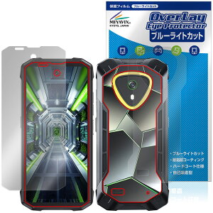 CUBOT KingKong Mini 4 �\�� �w�� �ی�t�B���� OverLay Eye Protector for �L���[�{�b�g �L���O�R���O �ڂɗD���� �u���[���C�g�J�b�g