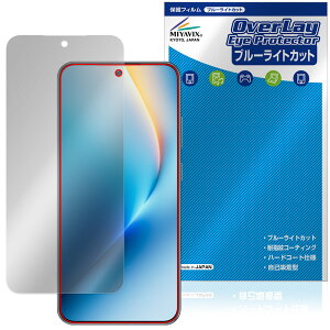 Honor Win RT �ی�t�B���� OverLay Eye Protector for �I�i�[ �X�}�[�g�t�H�� �t���ی� �ڂɗD���� �u���[���C�g�J�b�g